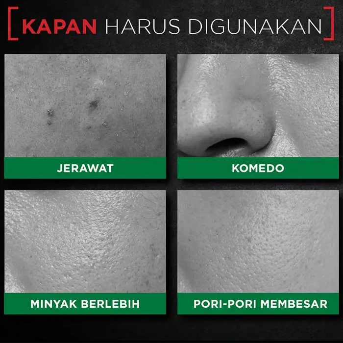 Garnier Men - Acno Fight - Super Mask 28 g. - Made in Indonesia