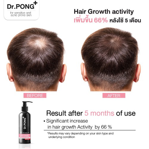 Dr.PONG - Tsutsuji Gentle Shampoo 200ml.