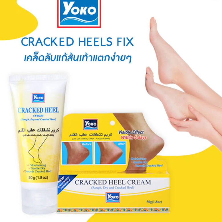 Yoko - Cracked Heel Cream 50g.