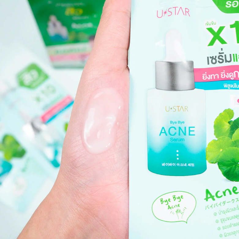 U-Star - Bye Bye Acne Serum 5g. (Pack of 3)