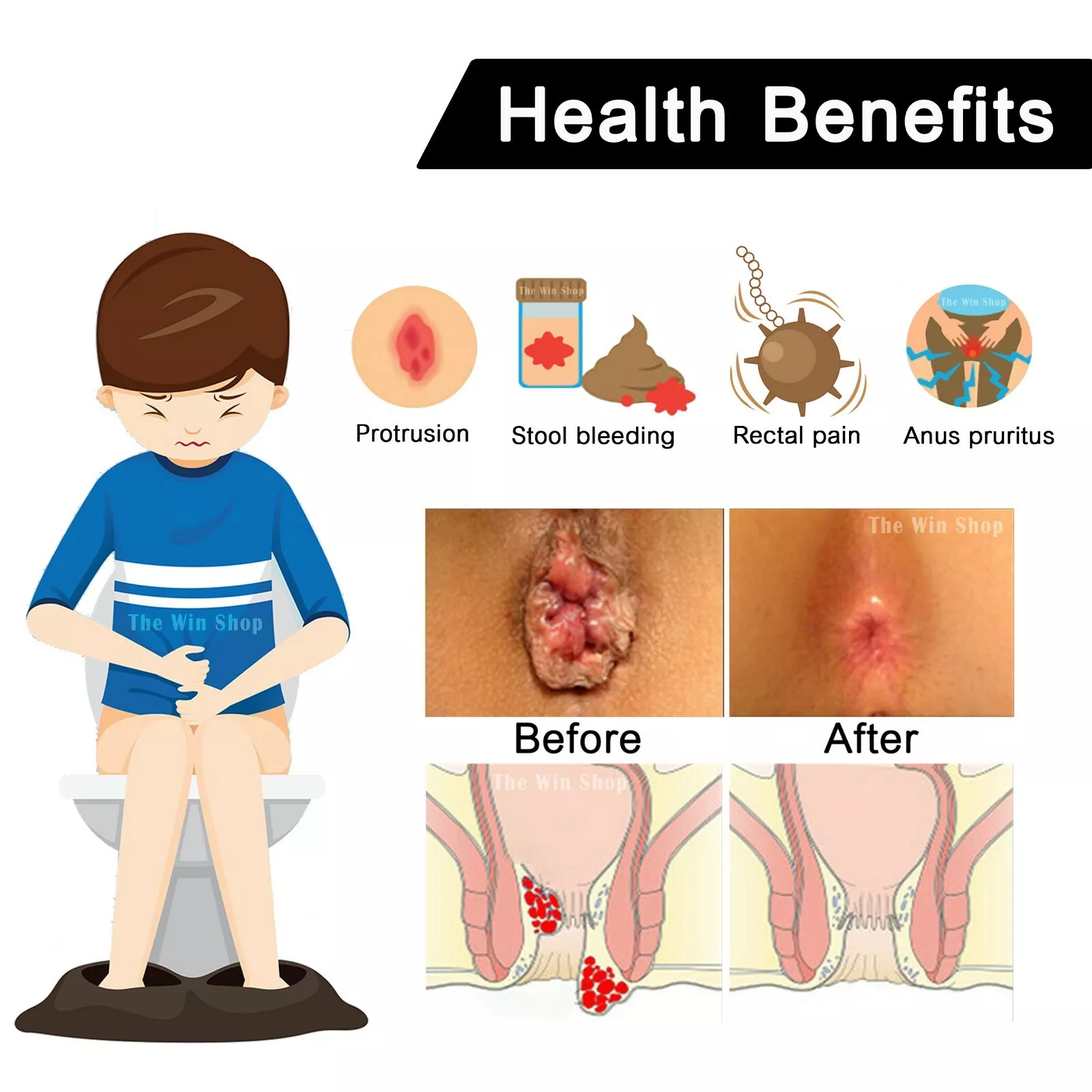 Herbal One - Compound Pet Sung Kat for hemorrhoids relief (100 capsules)