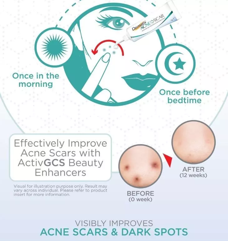 Dermatix - Acne Scar, Advanced Gel for Acne Scars & Spots 5g.