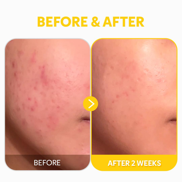 TIRTIR - Pure Vitamin C24 Serum 30ml.