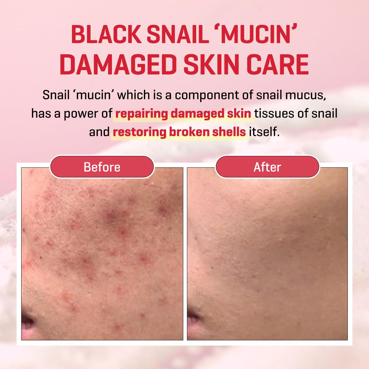 SOME BY MI - Snail Truecica Miracle Repair Serum 50ml.