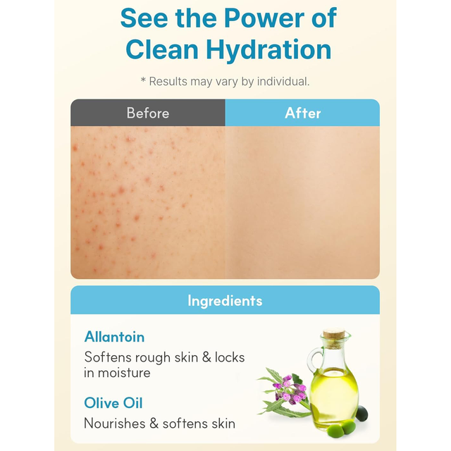 DERMA B - Daily Moisture Body Lotion 400ml.