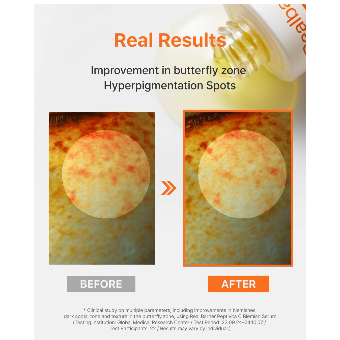 Real Barrier - Realbarrier Peptivita C Blemish Serum 30ml.