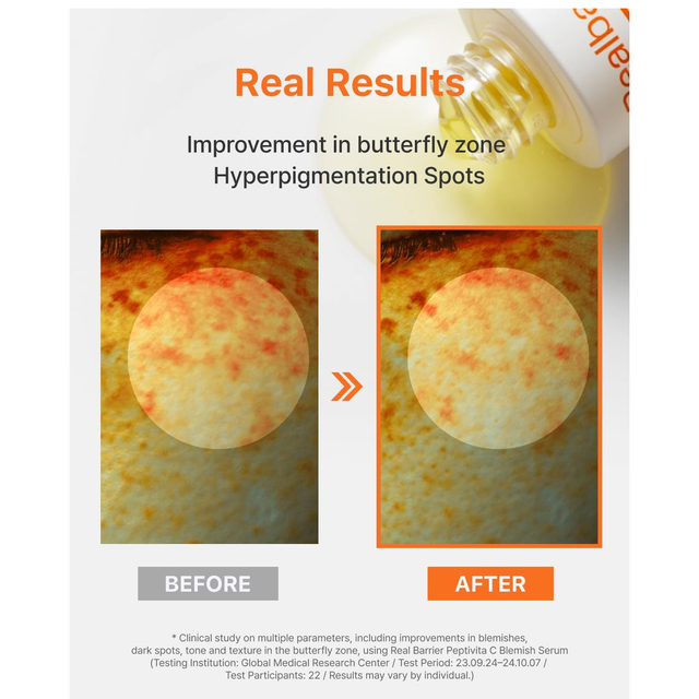 Real Barrier - Realbarrier Peptivita C Blemish Serum 30ml.