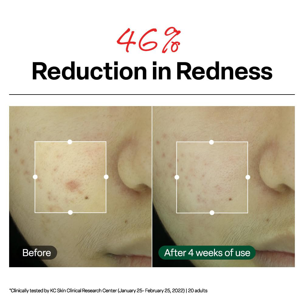 Dr.G - R.E.D Blemish Clear Soothing Cream 70ml.