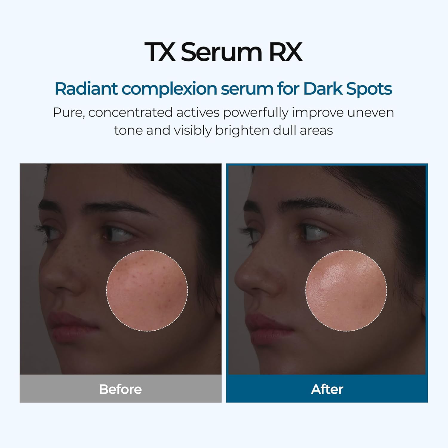 Dr.Melaxin - TX Ampoule Rx with Tranexamic Acid and Niacinamide 30ml.