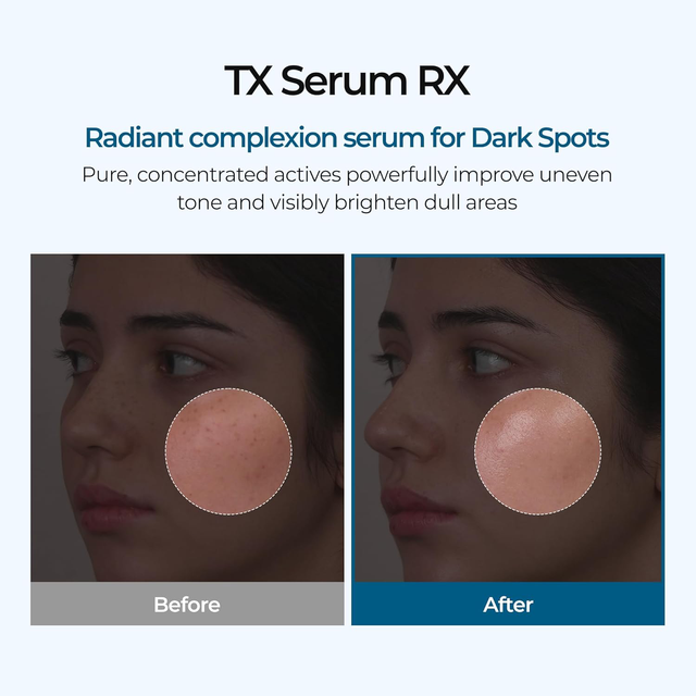 Dr.Melaxin - TX Ampoule Rx with Tranexamic Acid and Niacinamide 30ml.