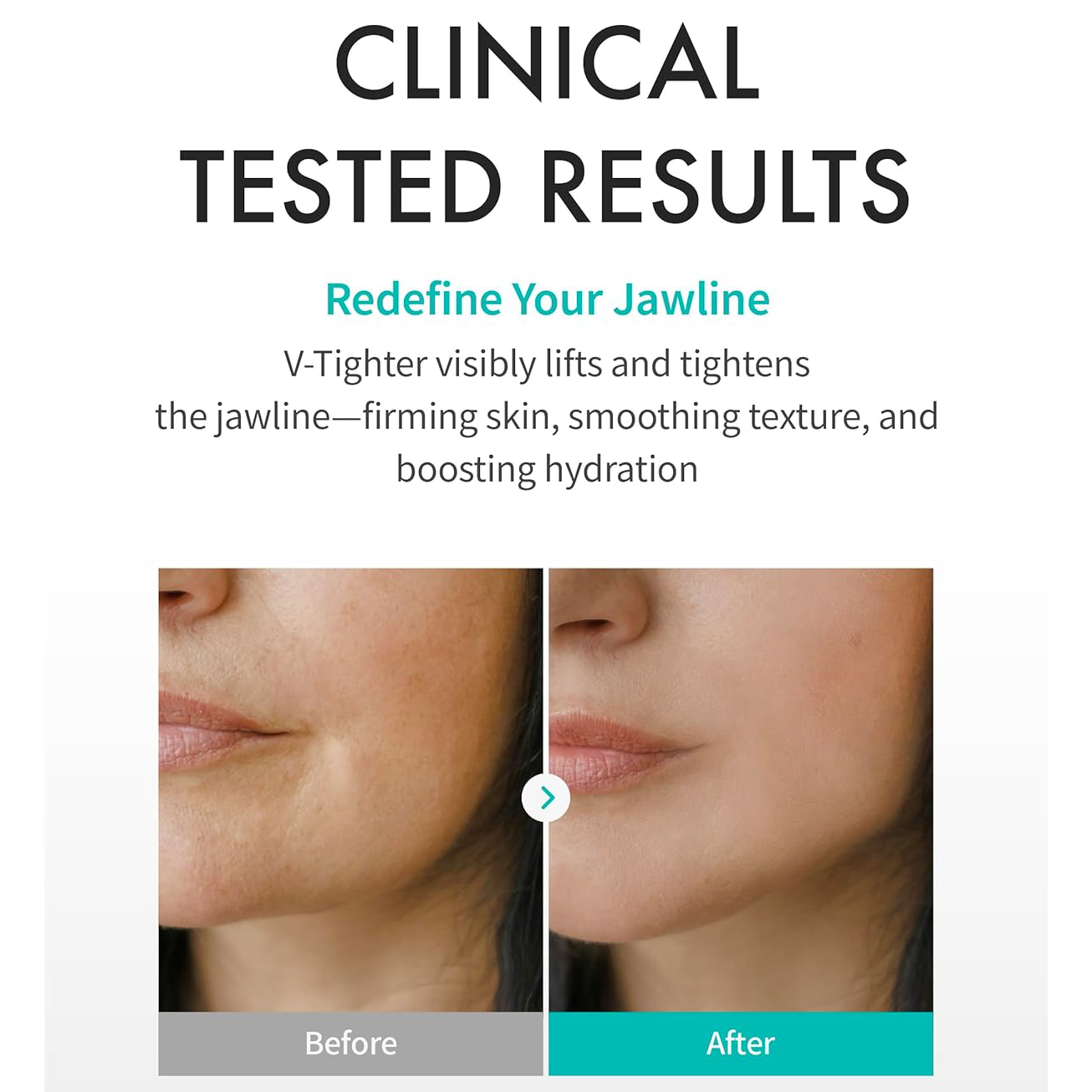 REJURAN - Perfect V Tighter c-PDRN 0.2% 20g. (4 Sheets)