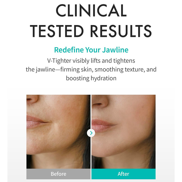 REJURAN - Perfect V Tighter c-PDRN 0.2% 20g. (4 Sheets)