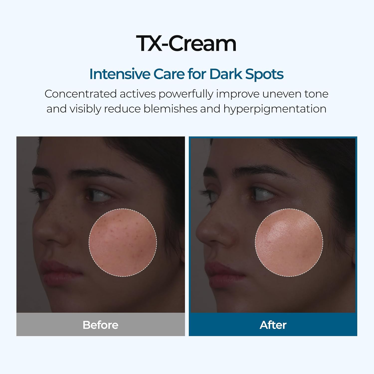 Dr.Melaxin - TX Cream with Tranexamic Acid and Niacinamide 50ml.