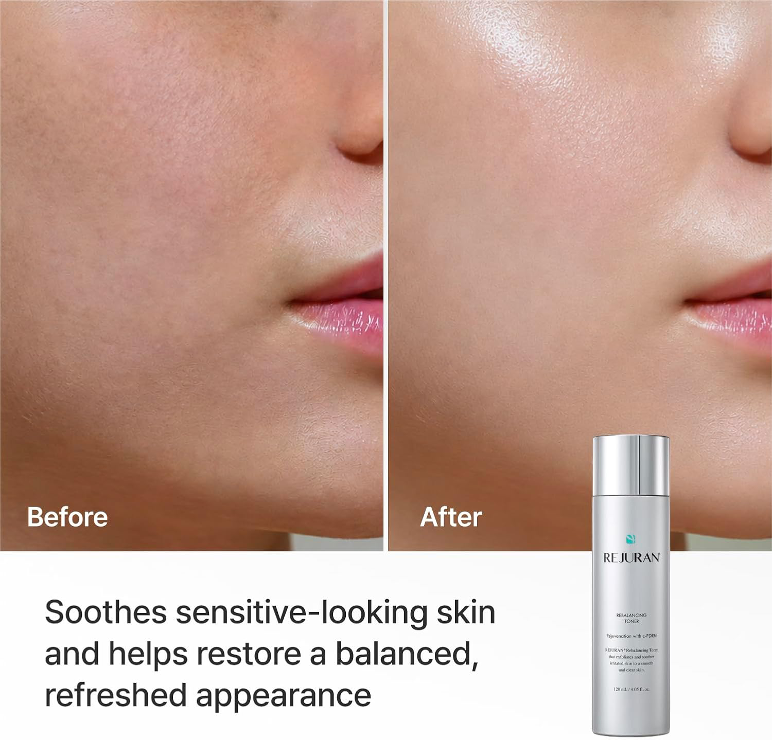 REJURAN - Rebalancing Toner with c-PDRN 120ml.