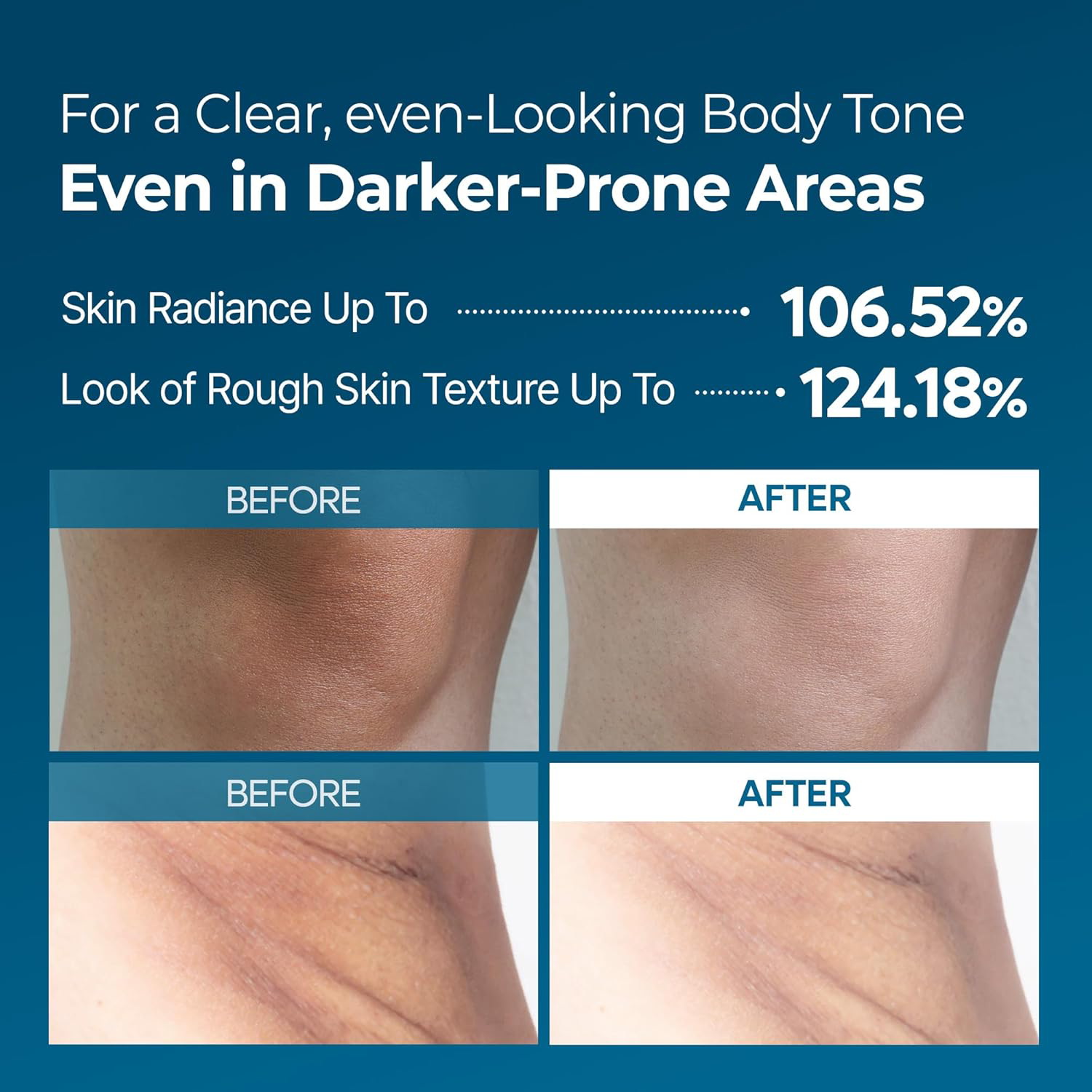 Dr.Melaxin - Peel Shot Body Exfoliating TX-Spray 200ml.