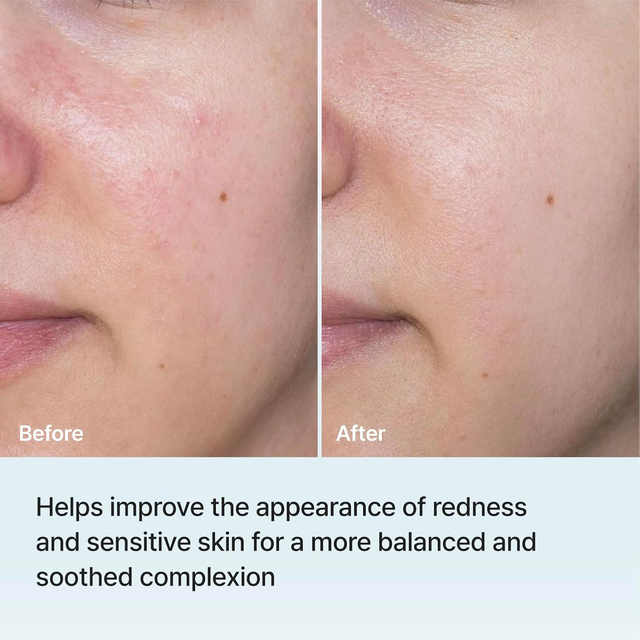 REJURAN - Moisture Treatment Mask PDRx 5% 23ml. (5 Sheets)