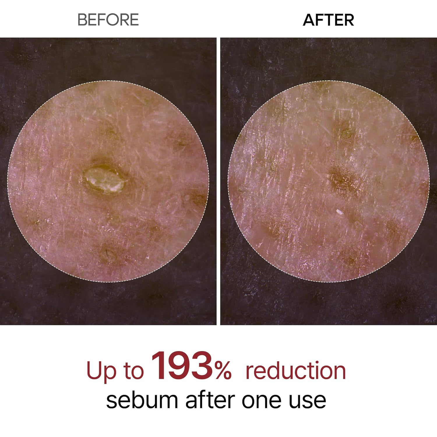 Dr.Melaxin - Peel Shot Exfoliant Rice Ampoule with Rice Bran Water H + Niacinamide 80ml.
