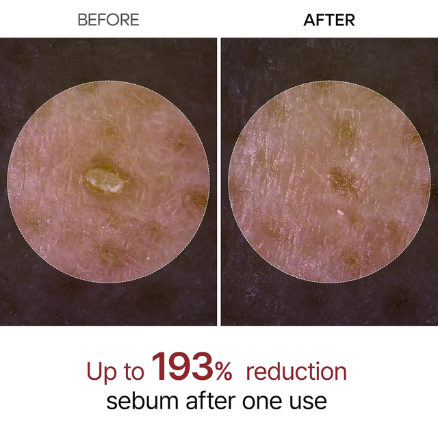 Dr.Melaxin - Peel Shot Exfoliant Rice Ampoule with Rice Bran Water H + Niacinamide 80ml.