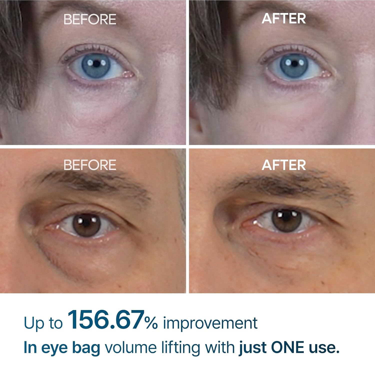 Dr.Melaxin - Eyephalt Eyebag Cream 10ml.