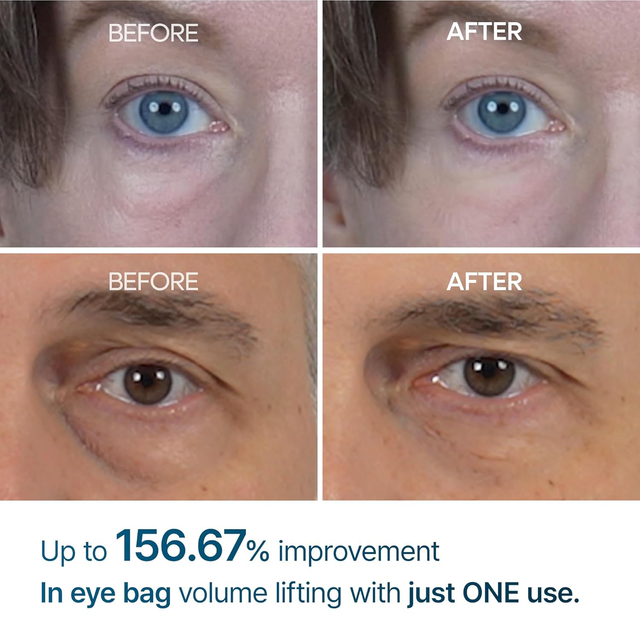 Dr.Melaxin - Eyephalt Eyebag Cream 10ml.