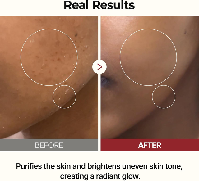 Dr.Melaxin - Peel Shot Glow Rice Toner 200ml.