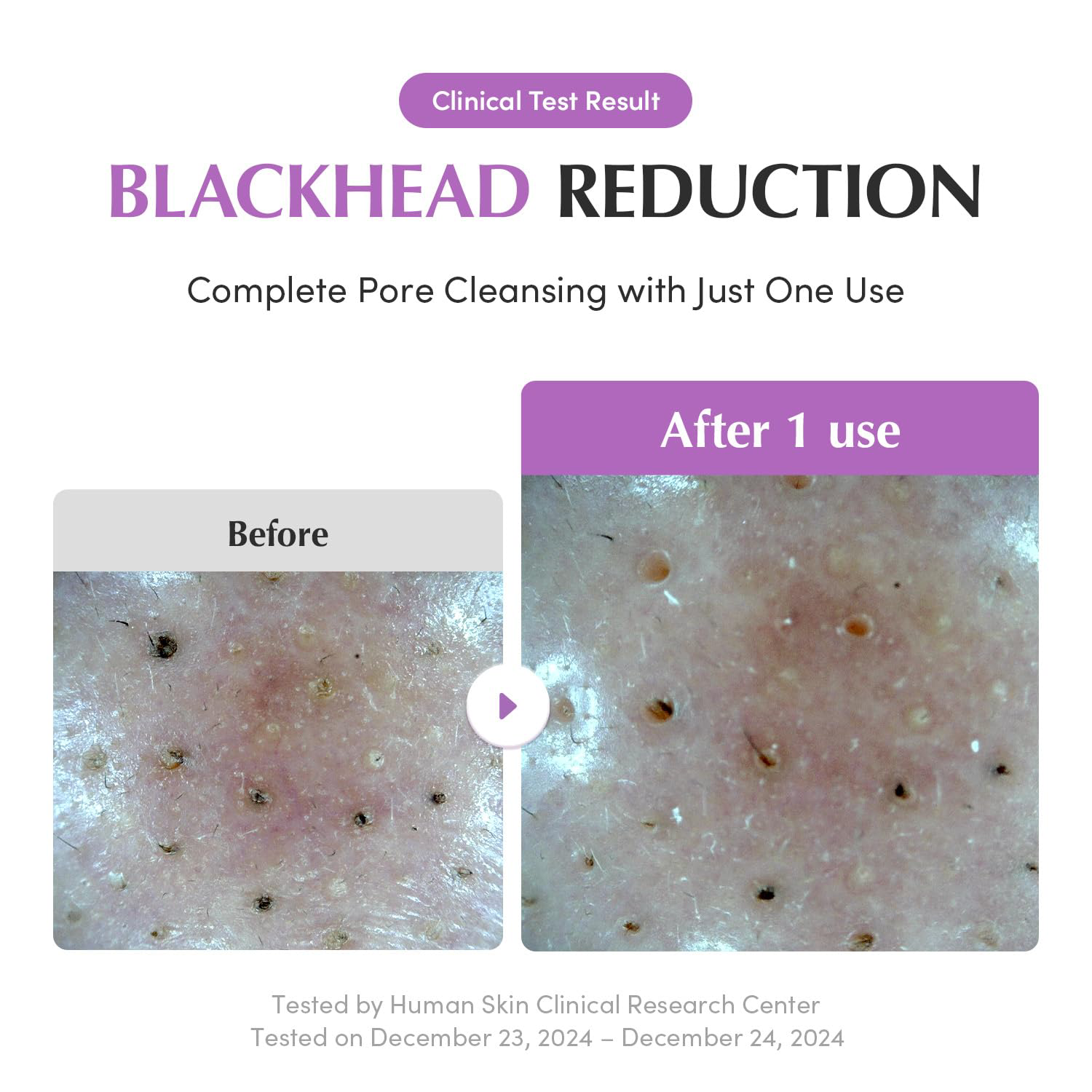 EQQUALBERRY - Purple Rice Pore Purifying Pack Cleanser 130g.