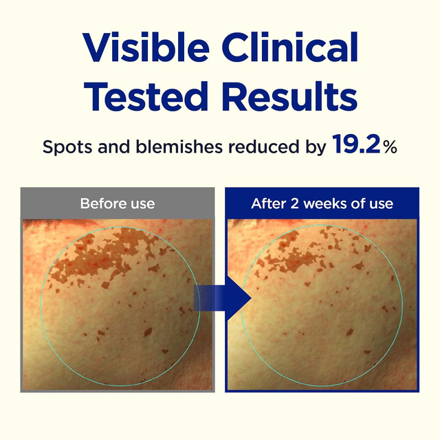 CKD GUARANTEED - Vita C Teca Triple Blemish Patch 82g. (60 Patches)