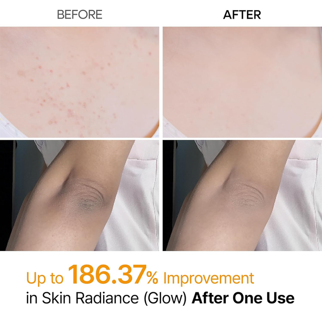Dr.Melaxin - Peel Shot Exfoliating Kojic Acid Turmeric Spray 200ml.