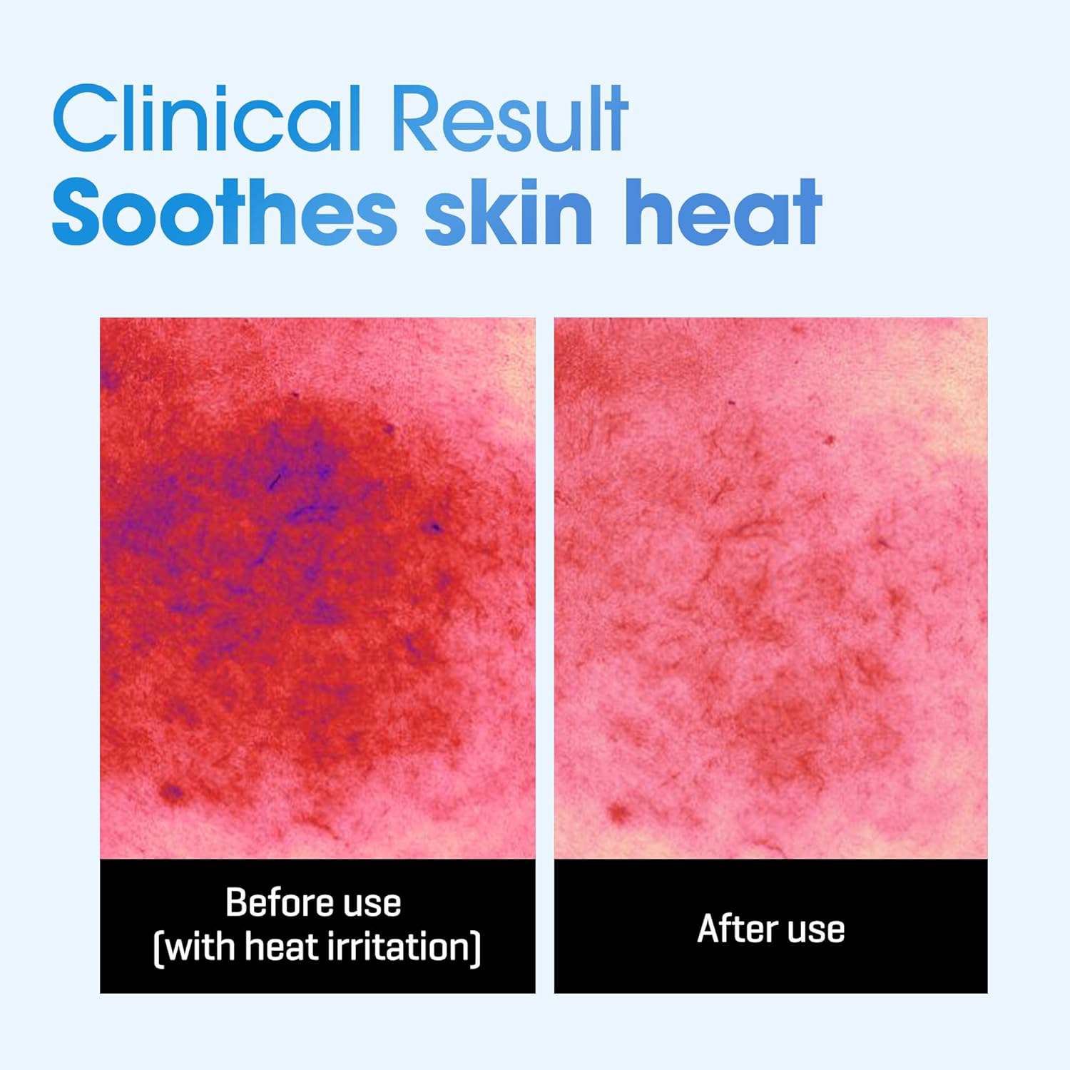 SOME BY MI - Beta Panthenol Repair Daily Mask (30 Sheets)