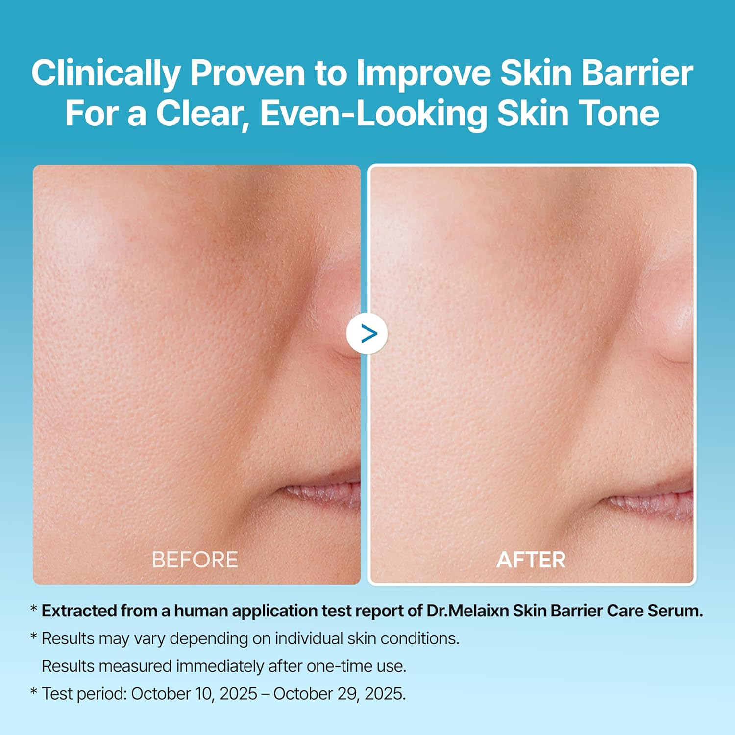 Dr.Melaxin - Peel Shot Exfoliating TX-Serum with Tranexanic Acid + Niacinamide 80ml.