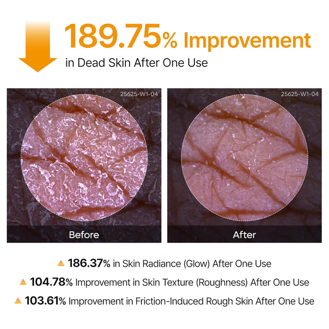 Dr.Melaxin - Peel Shot Exfoliating Kojic Acid Turmeric Spray 200ml.