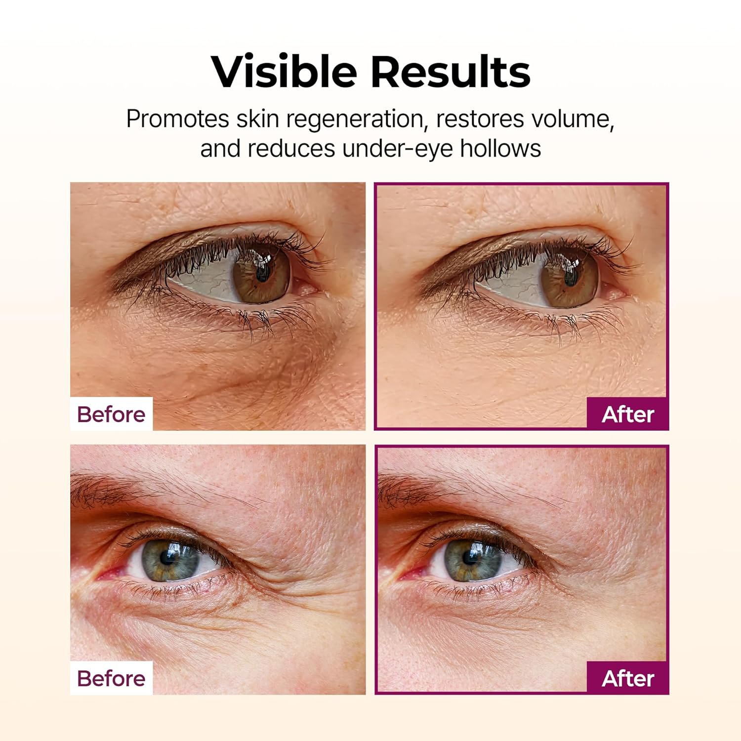 Dr.Melaxin - Cemenrete Calcium Volume Multi Balm Smooth Core Stick 9g.