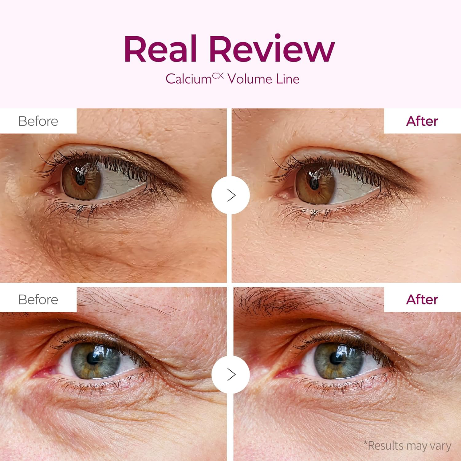 Dr.Melaxin - Cemenrete Calcium Volume Eye Patch (60 Patches)