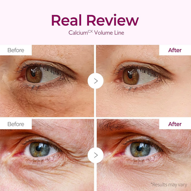 Dr.Melaxin - Cemenrete Calcium Volume Eye Patch (60 Patches)