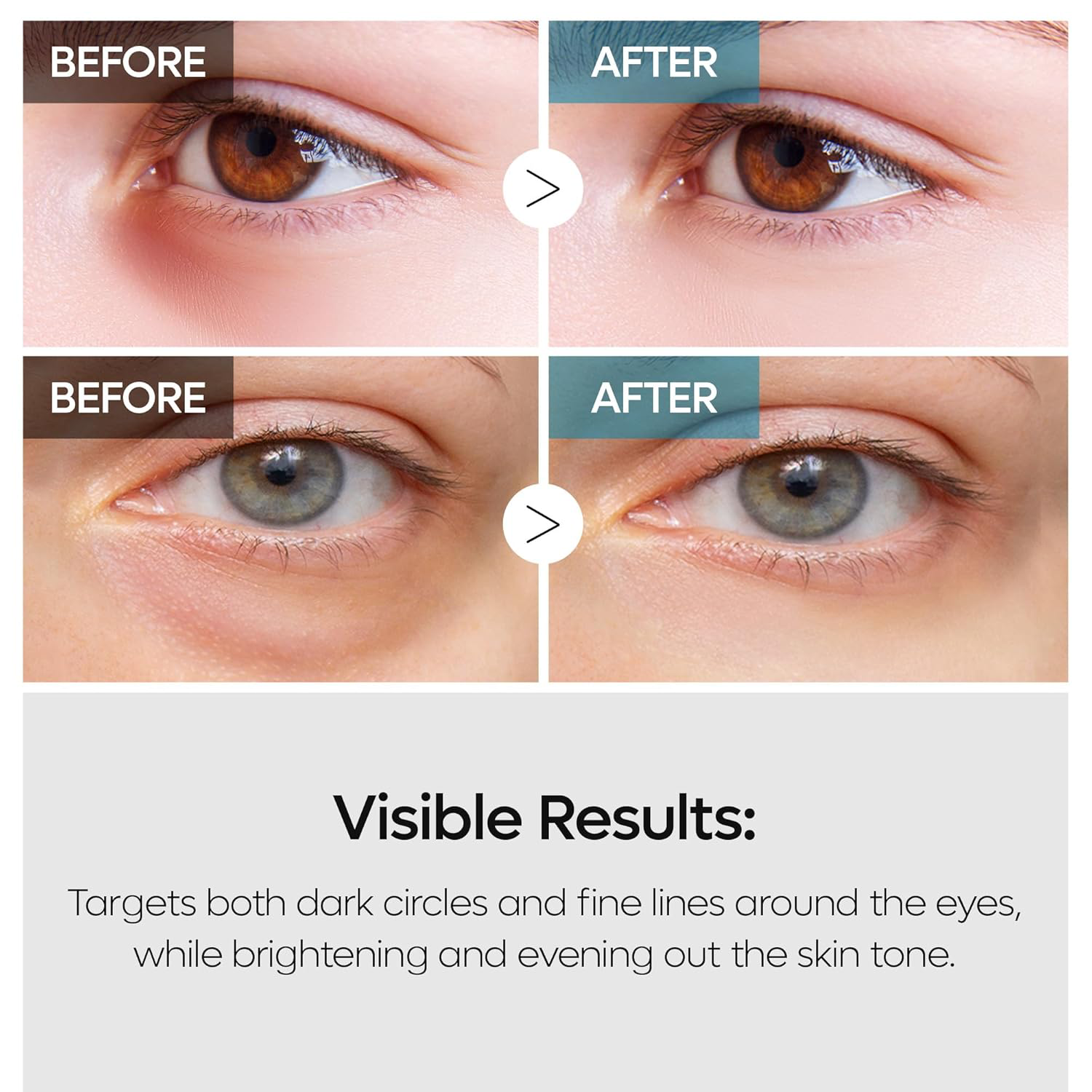 Dr.Melaxin - TX Retinalsome Double Effect Eyecream 40g.