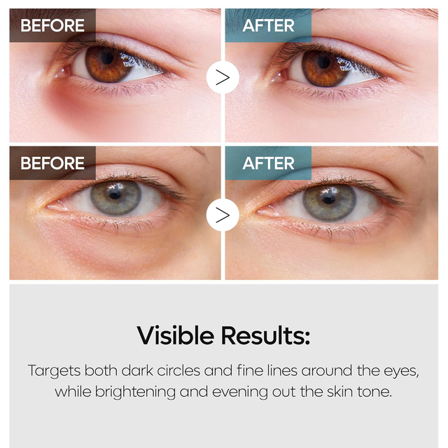 Dr.Melaxin - TX Retinalsome Double Effect Eyecream 40g.