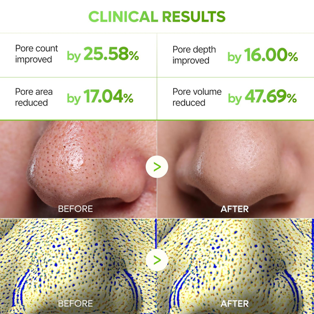 Dr.Melaxin - Cactox 3-Step Nose Mask Pack with AHA & PHA (Box of 3 Strips)