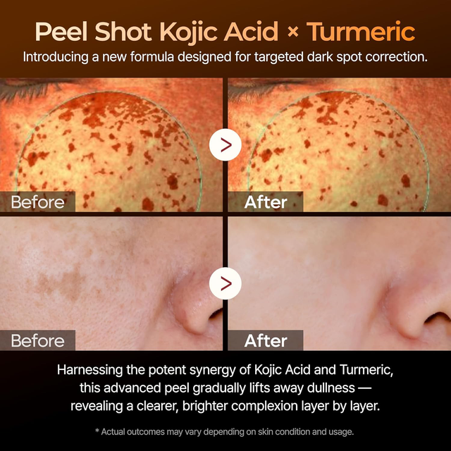 Dr.Melaxin - Peel Shot Exfoliating Kojic Acid Turmeric Serum with Glycolic Acid 80ml.