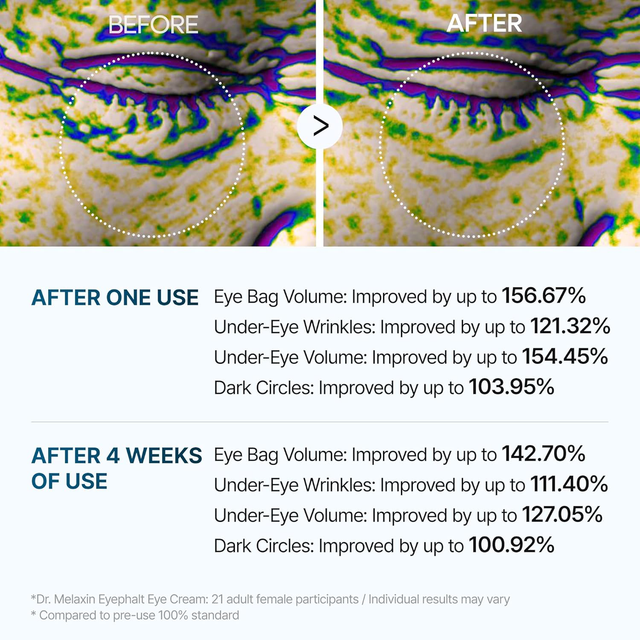 Dr.Melaxin - Eyephalt Eyebag Cream 10ml.
