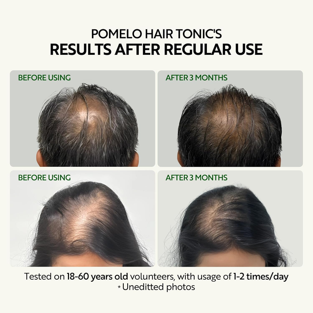 Cocoon Vietnam - Pomelo Hair Tonic (Nước Dưỡng Tóc Tinh Dầu Bưởi) with Pomelo Oil, Vitamin B5, Xylishine™, Baicapil™ & Bisabolol, Alcohol-Free 310ml.