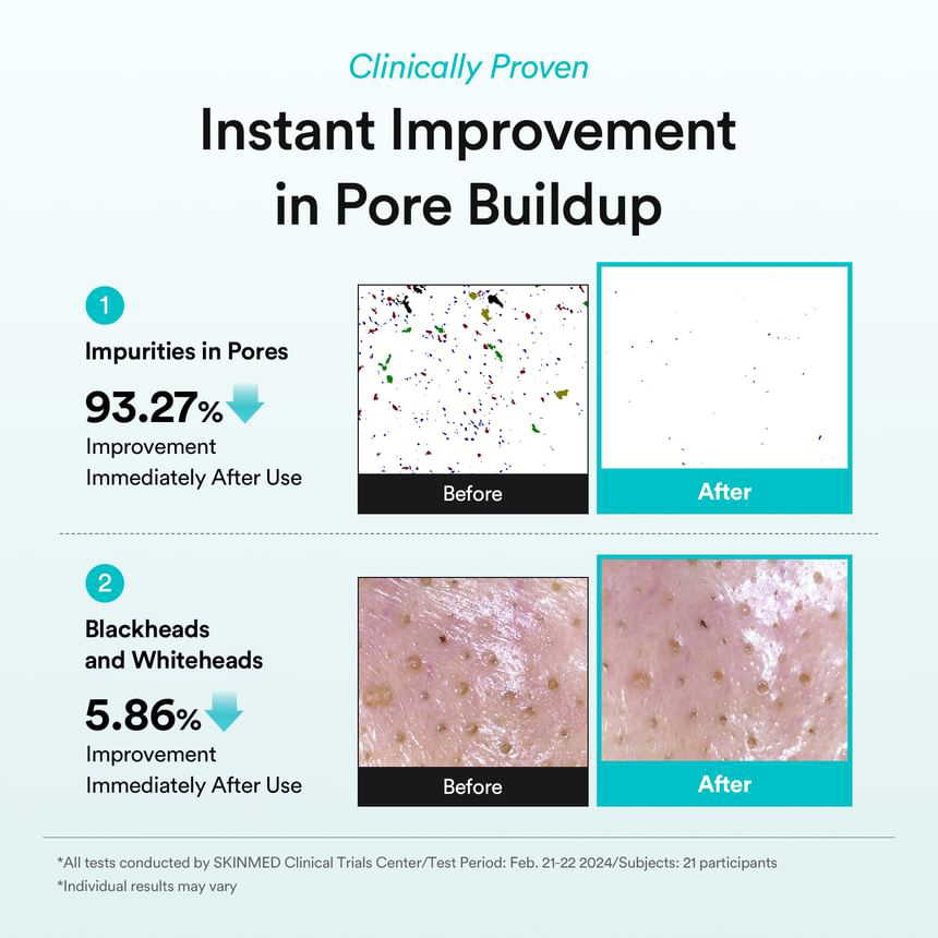 Abib - Green LHA Pore Pad Clear Touch 230ml. (70 Pads)