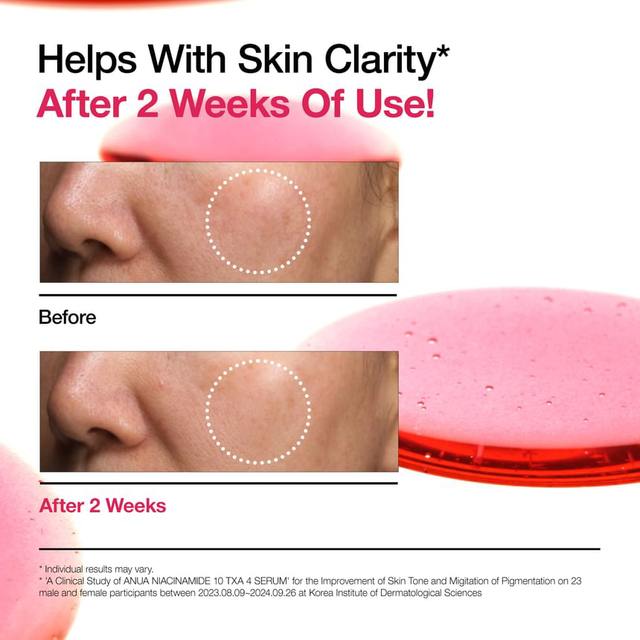 Anua - Bundle of: 1x Niacinamide 5 TXA Brightening Pad (60 Pads) + 1x Niacinamide 10 TXA 4 Serum 30ml.