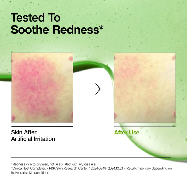 Anua - Bundle of: 1x Azelaic 10 Hyaluron Redness Soothing Pad (90 Pads) + 1x Azelaic Acid 10 Hyaluron Redness Soothing Serum 30ml.