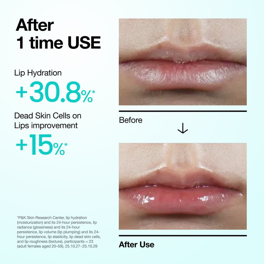 Anua - PDRN Lip Serum 10ml.