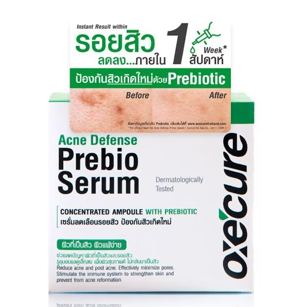 Oxe Cure - Acne Defense Prebio Serum 20mg.