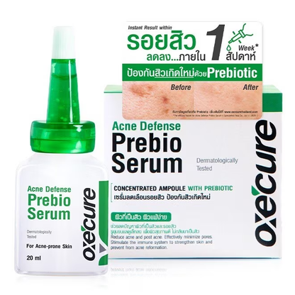 Oxe Cure - Acne Defense Prebio Serum 20mg.