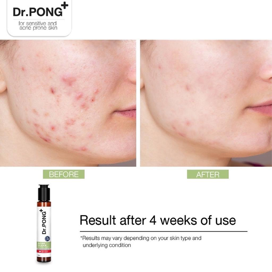 Dr.PONG - Acne Clear Glowing Toner 100ml.