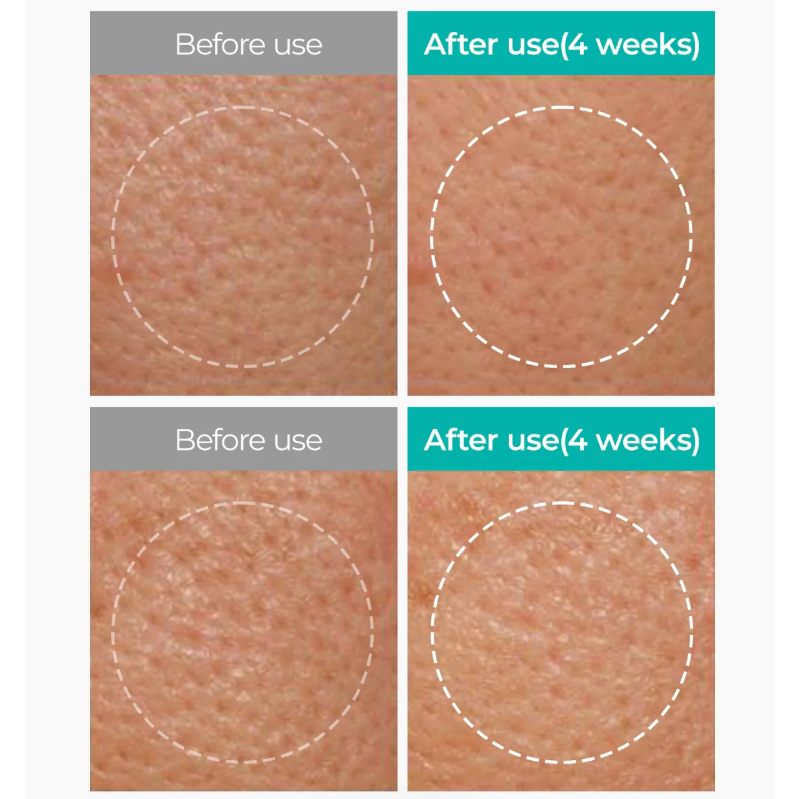 Dr.Melaxin - BP-Pore Clear Facial Mask Pack (5 Sheets)