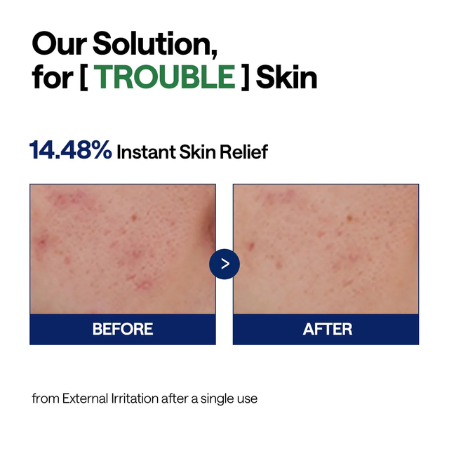 Mediheal - Bundle: 1x Mediheal Teatree Trouble Pad 170ml. (100 Pads) + 1x Mediheal Teatree Calming Hydra Serum 40ml.
