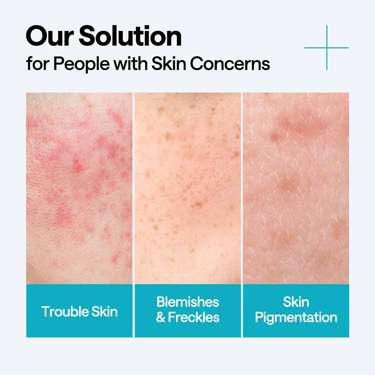 Mediheal - Bundle: 1x Mediheal Madecassoside Blemish Pad 170ml. (100 Pads) + 1x Mediheal Madecassoside Blemish Repair Serum 40ml.